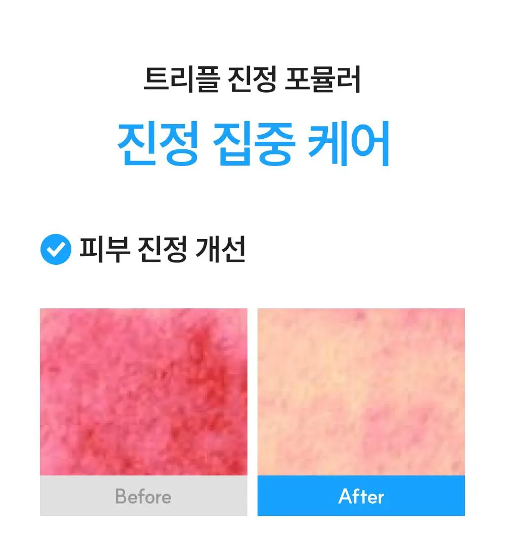 [1등 화잘먹 물먹세럼] 에스네이처 아쿠아 스쿠알란 세럼 50ml 기획 (+수분크림 10ml) 상세페이지 27